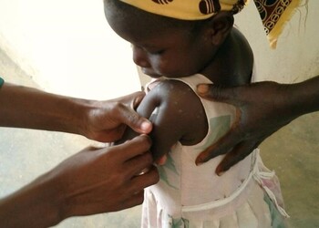 La OMS aprueba la primera vacuna contra la malaria