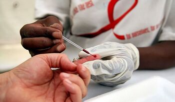 Advierten que habrá 7 millones de muertes por sida en 10 años