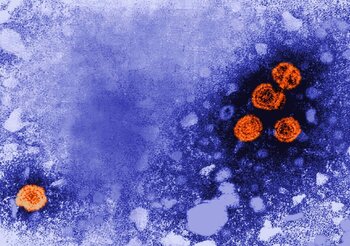 Investigan tres casos de hepatitis aguda de origen desconocido