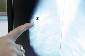 Pacientes de cáncer de mama denuncian listas de espera anuales
